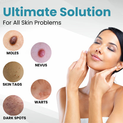 |Official Store| ✨Tnnedey®Non-Invasive Skin Imperfection Removal Pen✨