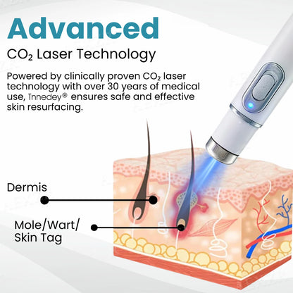 |Official Store| ✨Tnnedey®Non-Invasive Skin Imperfection Removal Pen✨