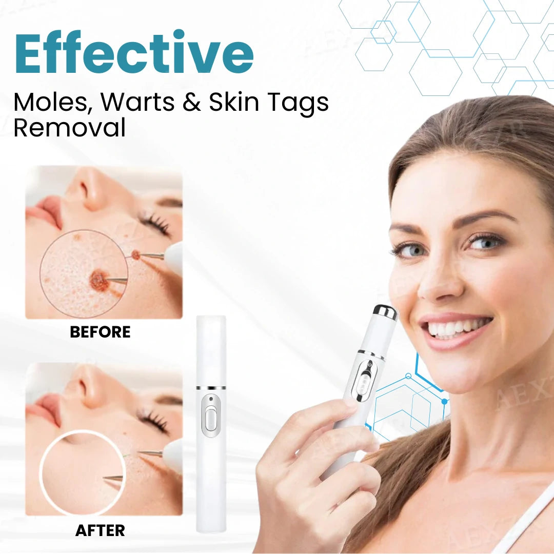 |Official Store| ✨Tnnedey®Non-Invasive Skin Imperfection Removal Pen✨