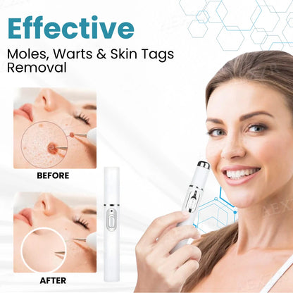 |Official Store| ✨Tnnedey®Non-Invasive Skin Imperfection Removal Pen✨